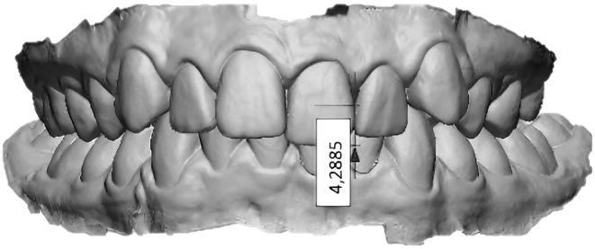 https://cdn.ncbi.nlm.nih.gov/pmc/blobs/50ff/12056454/64f0aa0303d8/OCR-28-458-g001.jpg