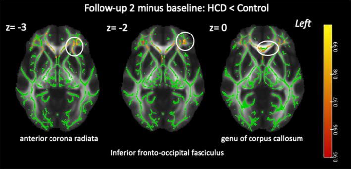 https://cdn.ncbi.nlm.nih.gov/pmc/blobs/5108/11946887/8f90675d4084/42255_2025_1226_Fig5_ESM.jpg