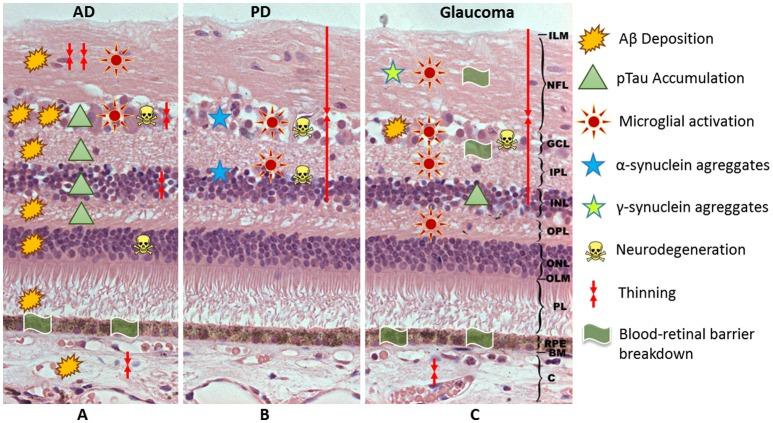 https://cdn.ncbi.nlm.nih.gov/pmc/blobs/5109/5498525/fd862d00f2ae/fnagi-09-00214-g0001.jpg