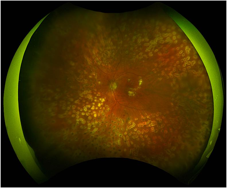 https://cdn.ncbi.nlm.nih.gov/pmc/blobs/510b/11566710/bb8786eba672/gr5.jpg