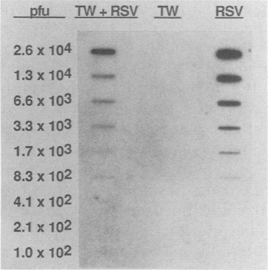 https://cdn.ncbi.nlm.nih.gov/pmc/blobs/511e/267664/9ede909adc1a/jcm00068-0047-a.jpg