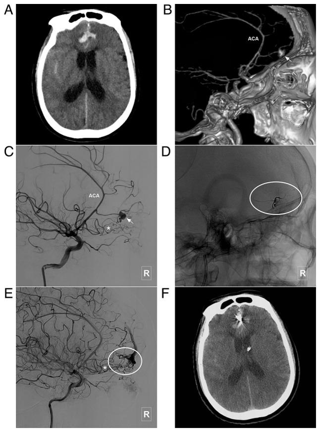 https://cdn.ncbi.nlm.nih.gov/pmc/blobs/511e/9829091/ed93f00184c2/mi-01-05-00022-g02.jpg