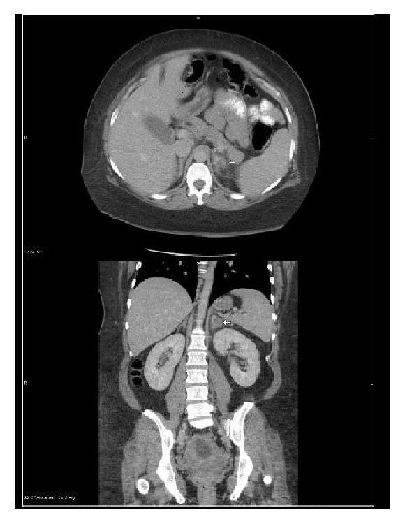 https://cdn.ncbi.nlm.nih.gov/pmc/blobs/511f/5380828/034c5045beb9/CRIOG2017-3167273.001.jpg