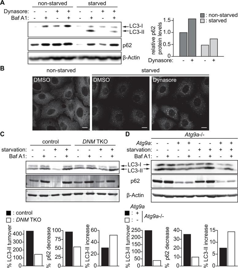 https://cdn.ncbi.nlm.nih.gov/pmc/blobs/5122/4991497/8c412288dc2a/oncotarget-07-20855-g007.jpg