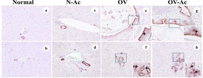 https://cdn.ncbi.nlm.nih.gov/pmc/blobs/5125/9080358/ef70791d1a49/APJCP-22-3903-g004.jpg