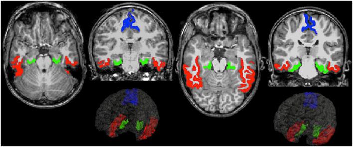 https://cdn.ncbi.nlm.nih.gov/pmc/blobs/5125/9849910/903aa2ce5a70/fnhum-16-1085986-g002.jpg