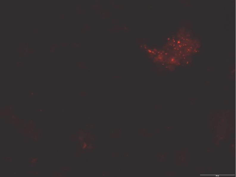 https://cdn.ncbi.nlm.nih.gov/pmc/blobs/512e/3536949/cc743cac058e/436_2012_3106_Fig3_HTML.jpg