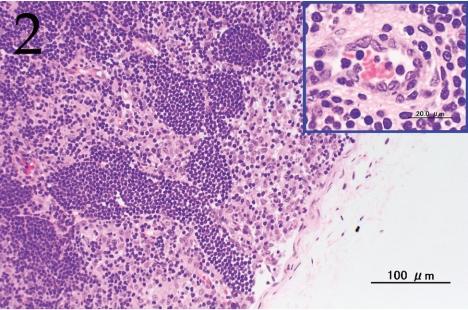 https://cdn.ncbi.nlm.nih.gov/pmc/blobs/5130/3234611/d3754b530523/tox-23-161-g002.jpg