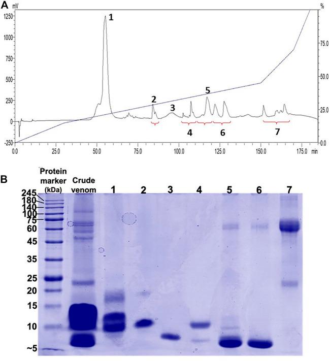 https://cdn.ncbi.nlm.nih.gov/pmc/blobs/5135/8740184/16c1fd07476a/fphar-12-727756-g002.jpg