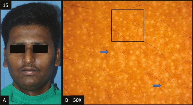 https://cdn.ncbi.nlm.nih.gov/pmc/blobs/5136/11126221/97ba204c1549/JCAS-17-112-g015.jpg