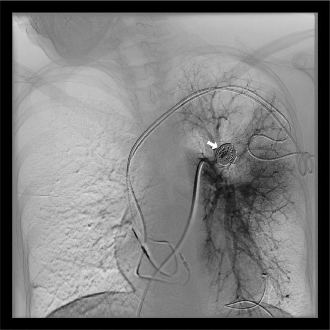 https://cdn.ncbi.nlm.nih.gov/pmc/blobs/5137/10563004/258983803c54/gr3.jpg