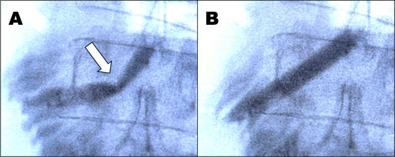 https://cdn.ncbi.nlm.nih.gov/pmc/blobs/5138/12004475/f35986801dde/tsaco-10-Suppl_1-g002.jpg