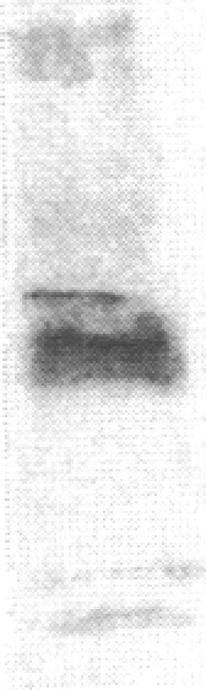 https://cdn.ncbi.nlm.nih.gov/pmc/blobs/5138/443026/d24bbab5a5d6/jcinvest00049-0183-f.jpg