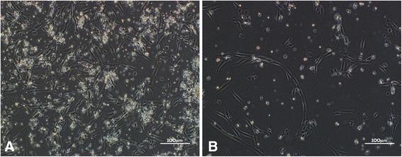 https://cdn.ncbi.nlm.nih.gov/pmc/blobs/5139/5845268/002c171edddf/13287_2018_782_Fig2_HTML.jpg