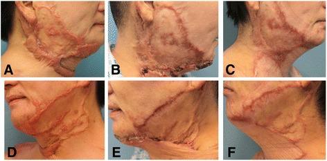 https://cdn.ncbi.nlm.nih.gov/pmc/blobs/5139/5845268/15988d71cad3/13287_2018_782_Fig1_HTML.jpg