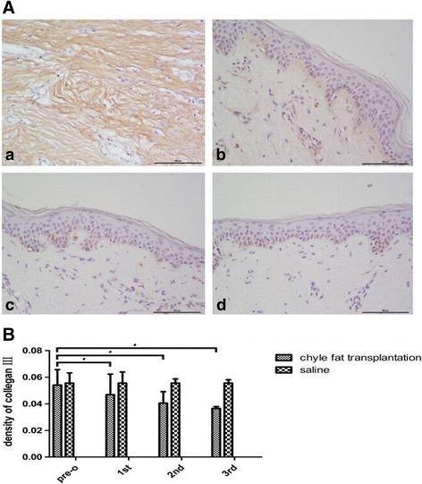 https://cdn.ncbi.nlm.nih.gov/pmc/blobs/5139/5845268/5d7127f93e63/13287_2018_782_Fig6_HTML.jpg