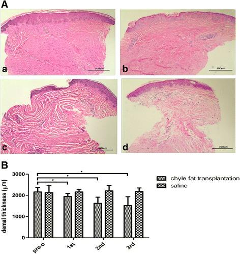 https://cdn.ncbi.nlm.nih.gov/pmc/blobs/5139/5845268/f1ff65ce1d3d/13287_2018_782_Fig4_HTML.jpg