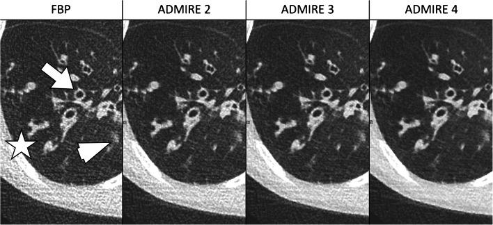 https://cdn.ncbi.nlm.nih.gov/pmc/blobs/513a/7398955/46803e73f313/247_2020_4714_Fig5_HTML.jpg