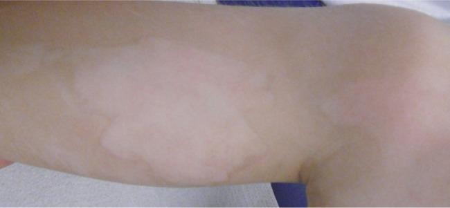 https://cdn.ncbi.nlm.nih.gov/pmc/blobs/513b/6239097/91008a83de1c/ccid-11-579Fig9.jpg