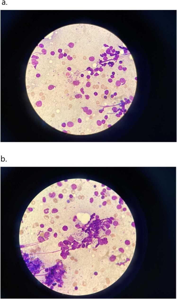 https://cdn.ncbi.nlm.nih.gov/pmc/blobs/5146/10149197/01c94e8d4422/gr1.jpg