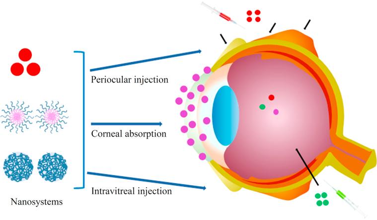 https://cdn.ncbi.nlm.nih.gov/pmc/blobs/514b/5430571/a0fe1d5ea117/fx1.jpg