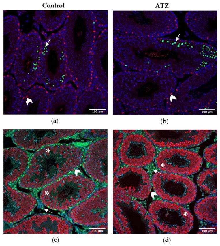 https://cdn.ncbi.nlm.nih.gov/pmc/blobs/514f/9954248/3ddaf7cad3c0/cells-12-00648-g004.jpg