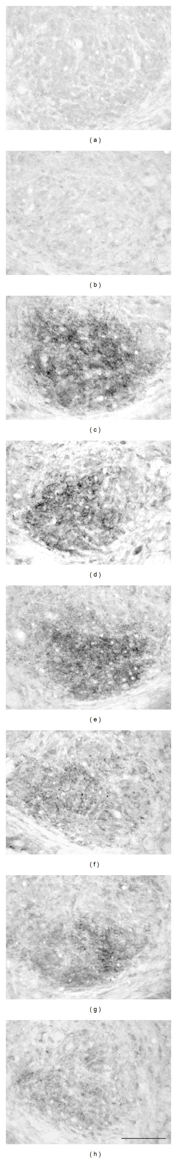 https://cdn.ncbi.nlm.nih.gov/pmc/blobs/5151/3227229/9fca524f6d22/ARP2012-921405.004.jpg