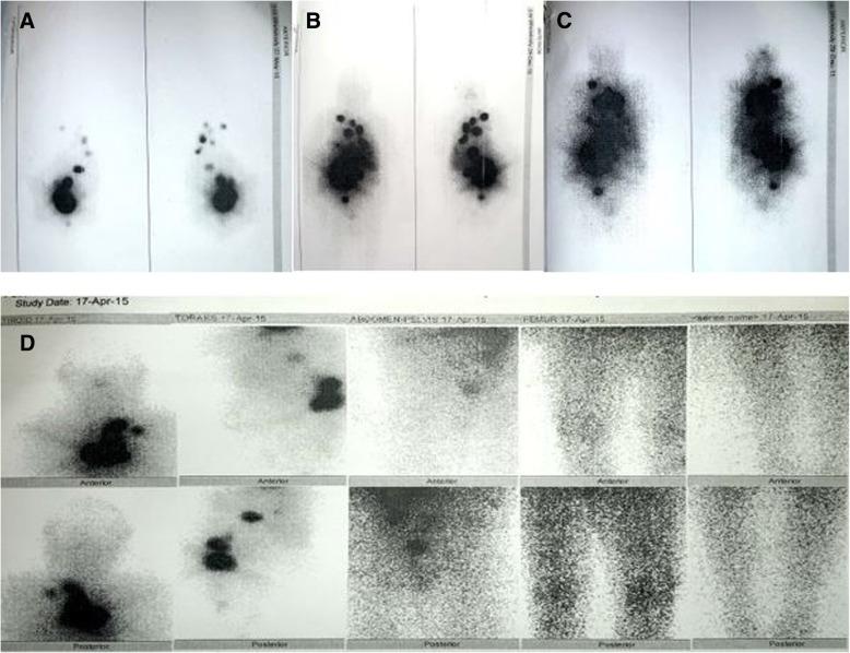 https://cdn.ncbi.nlm.nih.gov/pmc/blobs/5154/6475104/642eb9618db7/13256_2019_2025_Fig1_HTML.jpg