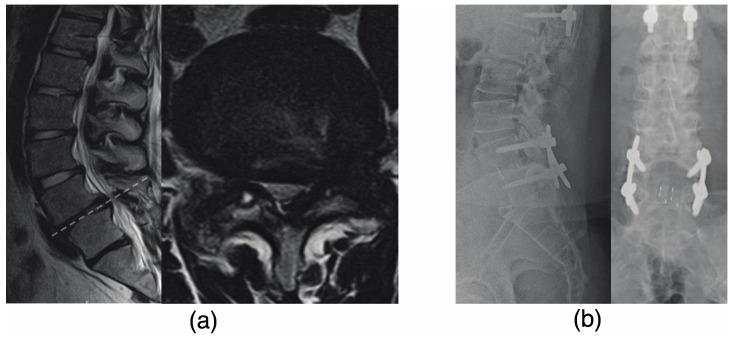 https://cdn.ncbi.nlm.nih.gov/pmc/blobs/5156/10488937/1f89a5bf44bc/jcm-12-05701-g003.jpg