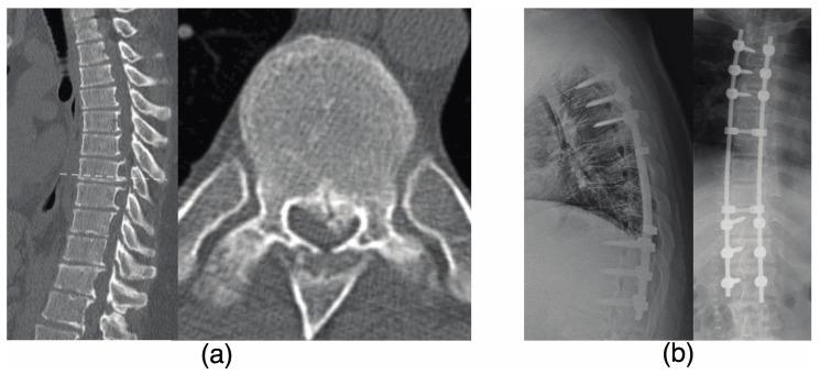 https://cdn.ncbi.nlm.nih.gov/pmc/blobs/5156/10488937/dced22540fe1/jcm-12-05701-g002.jpg