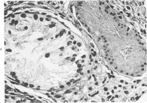 https://cdn.ncbi.nlm.nih.gov/pmc/blobs/5157/2042477/4966d340953e/amjpathol00237-0032-b.jpg