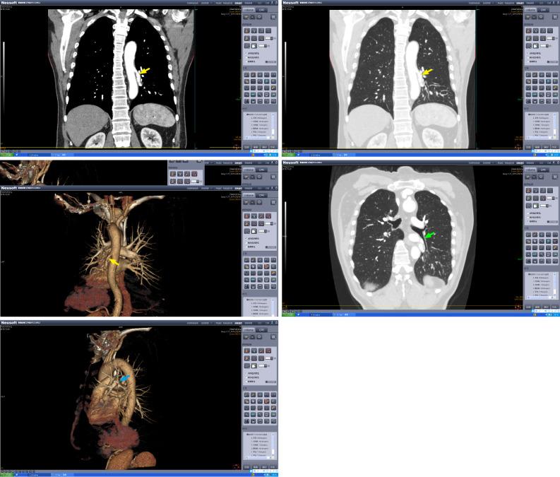 https://cdn.ncbi.nlm.nih.gov/pmc/blobs/5158/8462215/4cfadd9be048/WJCC-9-8192-g001.jpg