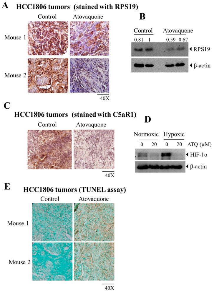 https://cdn.ncbi.nlm.nih.gov/pmc/blobs/5159/8152242/4a5482bdf069/ijms-22-05150-g005.jpg