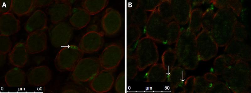 https://cdn.ncbi.nlm.nih.gov/pmc/blobs/5159/8504190/f0741aef76a2/iovs-62-13-3-f007.jpg