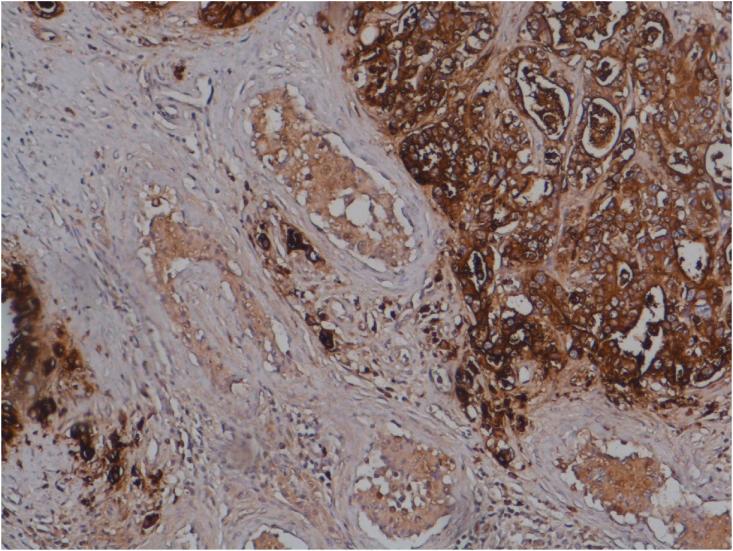 https://cdn.ncbi.nlm.nih.gov/pmc/blobs/5161/7758356/ca6028f86af7/gr3.jpg