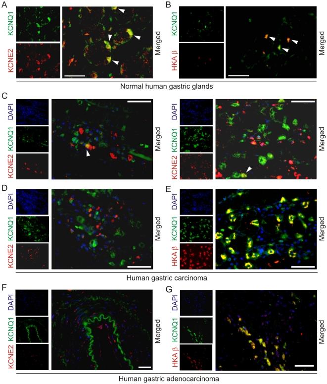 https://cdn.ncbi.nlm.nih.gov/pmc/blobs/5169/2897890/57153632ed92/pone.0011451.g006.jpg