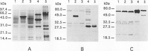 https://cdn.ncbi.nlm.nih.gov/pmc/blobs/516f/186371/3274ee695ceb/iai00005-0144-a.jpg