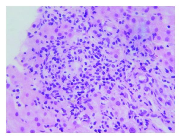 https://cdn.ncbi.nlm.nih.gov/pmc/blobs/5170/3966260/8f25e43cba8a/CRIGM2014-956463.003.jpg