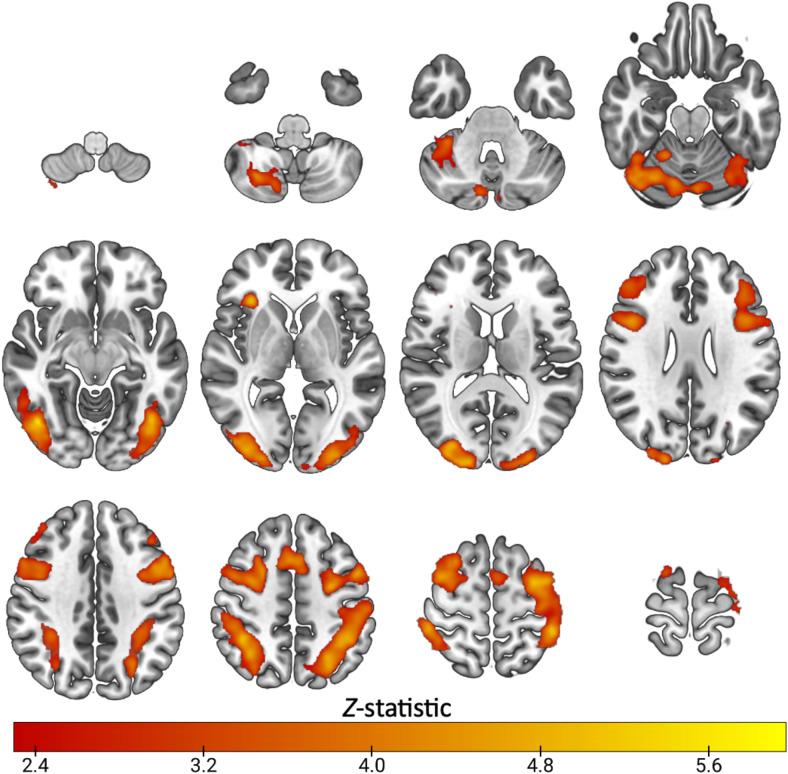 https://cdn.ncbi.nlm.nih.gov/pmc/blobs/5174/12272189/889c00b9d491/imag_a_00190_fig6.jpg