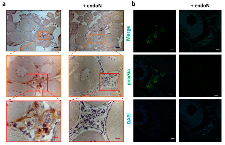 https://cdn.ncbi.nlm.nih.gov/pmc/blobs/5175/7693511/7f90fe579b7b/cells-09-02391-g007.jpg