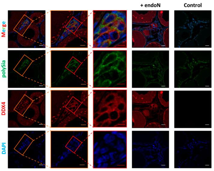 https://cdn.ncbi.nlm.nih.gov/pmc/blobs/5175/7693511/e74a15b4a4ec/cells-09-02391-g008.jpg