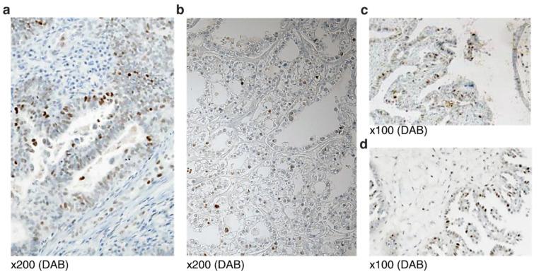 https://cdn.ncbi.nlm.nih.gov/pmc/blobs/5180/8947437/0210ba58b45e/diagnostics-12-00579-g001.jpg