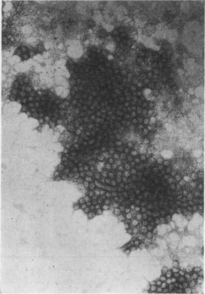 https://cdn.ncbi.nlm.nih.gov/pmc/blobs/5183/1647848/720d09ebf971/archdisch00877-0054-a.jpg