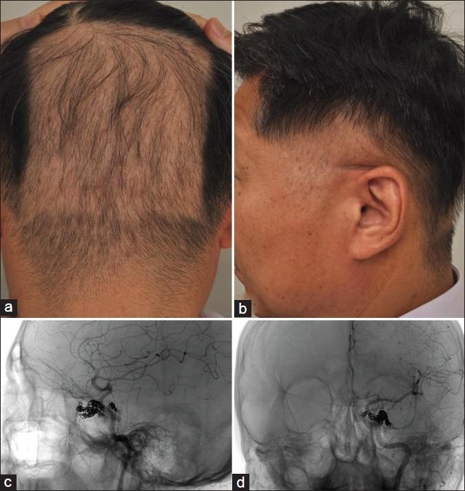 https://cdn.ncbi.nlm.nih.gov/pmc/blobs/5186/3500056/b2eb1c2119c1/IJT-4-164-g002.jpg