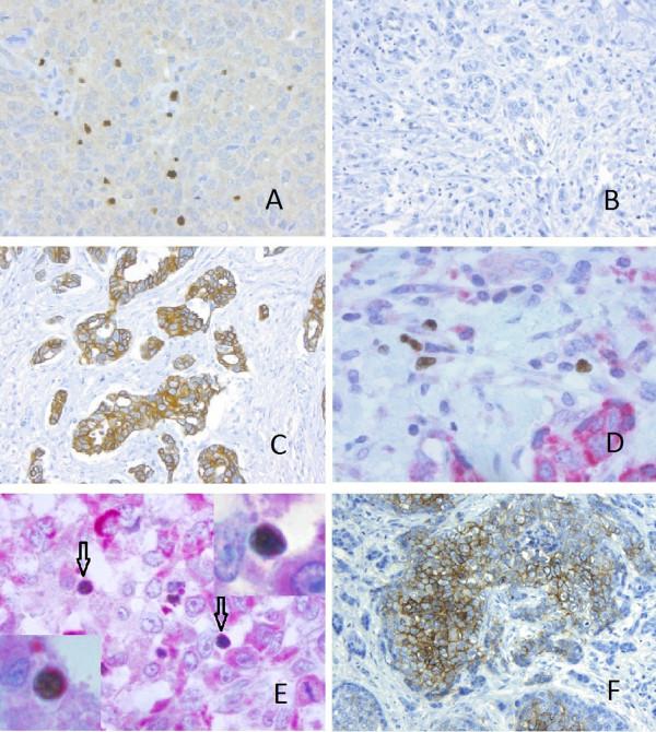 https://cdn.ncbi.nlm.nih.gov/pmc/blobs/518a/3219210/82671d36127f/bcr2869-1.jpg
