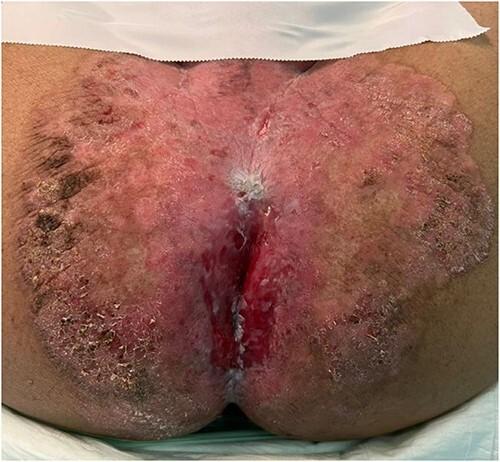 https://cdn.ncbi.nlm.nih.gov/pmc/blobs/518e/10276950/90b1f05bc1b2/rjad291f1.jpg