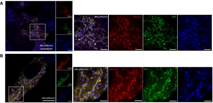 https://cdn.ncbi.nlm.nih.gov/pmc/blobs/518f/8811651/6d4b4e7fbdd8/EMBR-23-e48754-g014.jpg