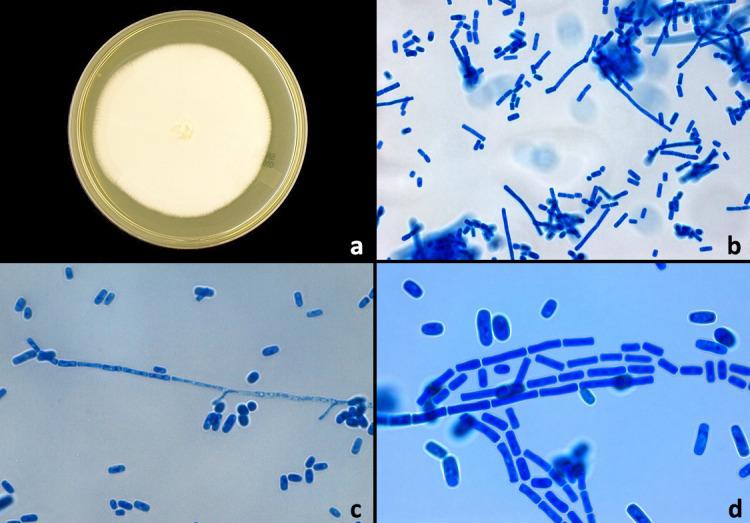 https://cdn.ncbi.nlm.nih.gov/pmc/blobs/5192/7470357/f376b470dacb/acmi-1-001-g002.jpg