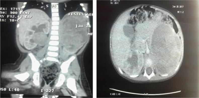 https://cdn.ncbi.nlm.nih.gov/pmc/blobs/519a/6143887/cf3d07912162/AIPM-16-73_F3.jpg