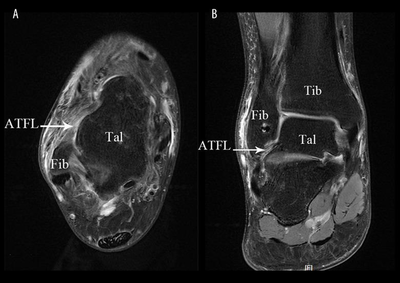 https://cdn.ncbi.nlm.nih.gov/pmc/blobs/519b/7893828/01ef88a043f3/medscimonit-27-e928526-g004.jpg
